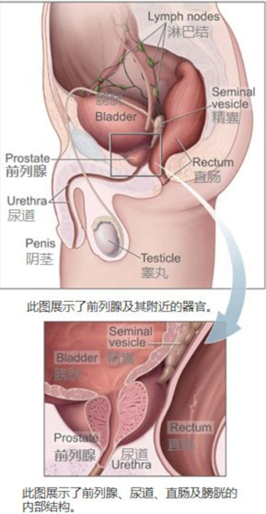 前列腺