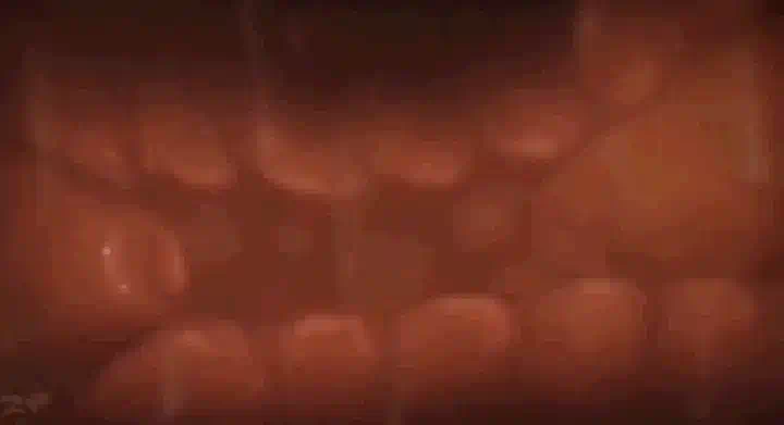 九淺一深