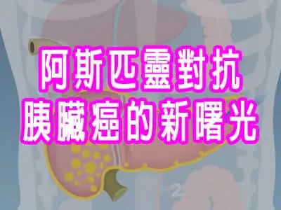阿斯匹靈對抗胰臟癌的新曙光