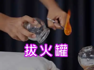拔火罐