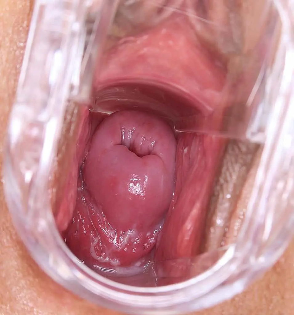 痾尿落隻閪入面